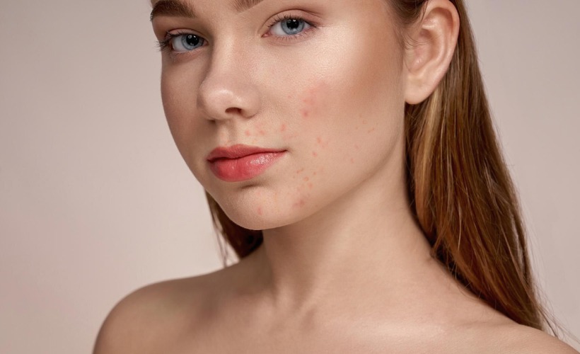 Dejstvo aktivnog kiseonika, slika pre